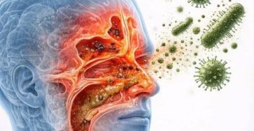 647690146 122301272480022929 1869205836076190960 n