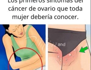 669359969 966687925889880 1081384067294003519 n 300x263